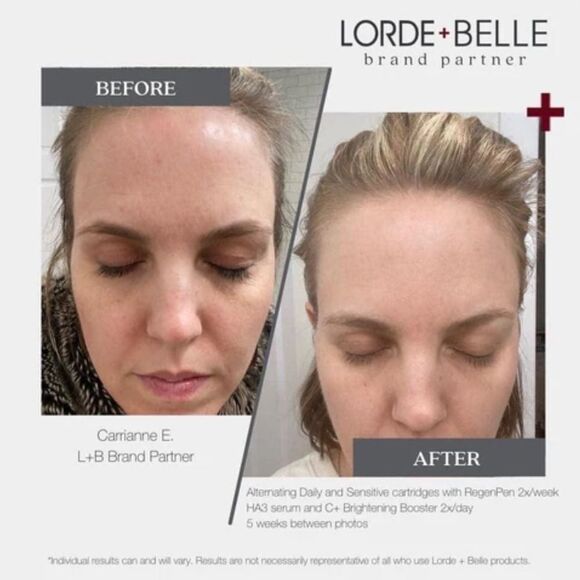 NIB Lorde + Belle BOOSTER BUNDLE OF ALL 5: use with Repair Serum - MSRP $249 - Picture 13 of 15